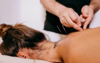 Anatomy, Ashi Points & A Dry Needling Road Map for Acupuncturists | SPORTSMEDICINEACUPUNCTURE.COM